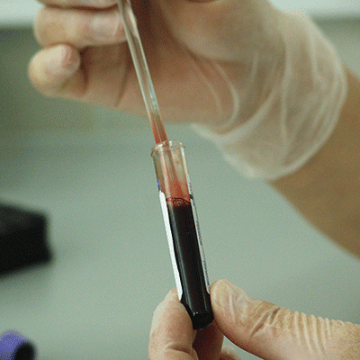 Eine Person mit Handschuhen entnimmt mit einer Glaspipette eine rote Flüssigkeit aus einem Reagenzglas. Die Szene scheint in einem Labor zu spielen.