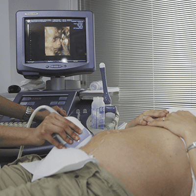 Eine Person liegt mit freiliegendem Bauch, während eine Ultraschalluntersuchung durchführt wird. Das Gerät zeigt auf dem Bildschirm ein Bild eines Fötus. Auf dem Bauch der Person sind ein Ultraschallstab und etwas Gel zu sehen.