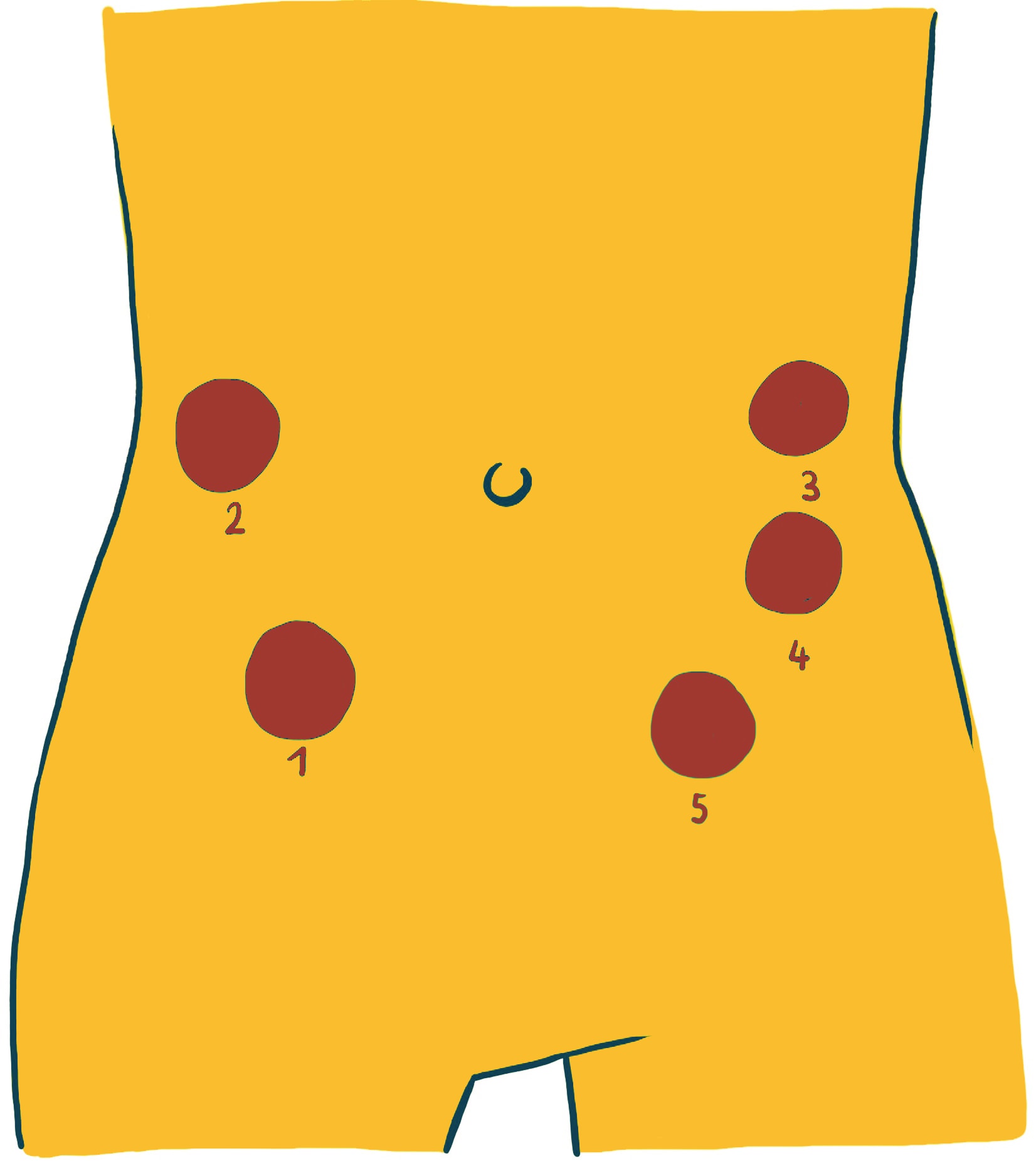Colonmassage: Abbildung eines gelben Torsos mit fünf beschrifteten roten Punkten. Die Punkte sind von unten links nach oben rechts mit 1, 2, 3, 4 und 5 nummeriert.